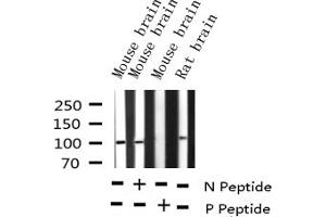 Western blot analysis of Phospho-GluR1 (Ser863) expression in various lysates (Glutamate Receptor 1 抗体  (pSer863))