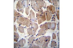 Immunohistochemistry (Paraffin-embedded Sections) (IHC (p)) image for anti-Ribosomal Protein S6 Kinase, 52kDa, Polypeptide 1 (RPS6KC1) (AA 19-47), (N-Term) antibody (ABIN954626)