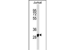 Western blot analysis in Jurkat cell line lysates (35ug/lane). (OR1N1 抗体  (C-Term))
