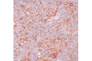 Immunohistochemical staining of mouse thymus tissue with TMEM38B polyclonal antibody  at 5 ug/mL dilution. (TMEM38B 抗体  (C-Term))