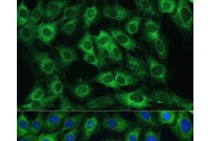 Immunofluorescence analysis of C6 cells using FRMD6 Polyclonal Antibody at dilution of 1:100.