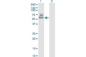 Western Blotting (WB) image for anti-ATPase, H+ Transporting, Lysosomal 70kDa, V1 Subunit A (ATP6V1A) (AA 508-617) antibody (ABIN513626)