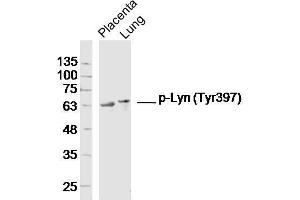 Lane 1: Mouse placenta lysates, Lane 2: Mouse lung lysates probed with Lyn (Tyr397) Polyclonal Antibody, Unconjugated  at 1:300 overnight at 4˚C. (LYN 抗体  (pTyr397))