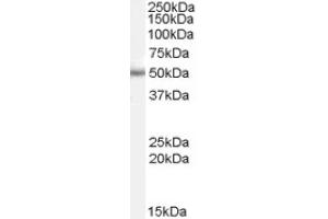 Image no. 1 for anti-Paired Box 6 (PAX6) (Internal Region) antibody (ABIN374758) (PAX6 抗体  (Internal Region))