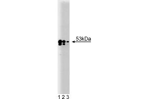 Western Blotting (WB) image for anti-TEA Domain Family Member 1 (SV40 Transcriptional Enhancer Factor) (TEAD1) (AA 86-199) antibody (ABIN968252) (TEAD1 抗体  (AA 86-199))