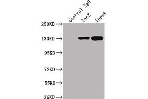 Immunoprecipitating lacZ in 293T transfected whole cell lysate   Lane 1: Mouse control IgG instead of ABIN7141389 in 293T transfected whole cell lysate. (LacZ 抗体)