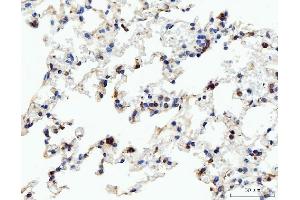 IHC analysis of Acid Phosphatase/ACP5 using anti-Acid Phosphatase/ACP5 antibody (ABIN7601574).