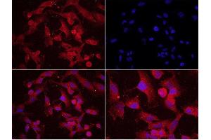 Immunofluorescence (Cultured Cells) (IF (cc)) image for anti-Microtubule-Associated Protein 2 (MAP2) (pSer136) antibody (ABIN743648)