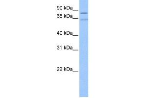 WB Suggested Anti-ZNF724P Antibody Titration:  0. (ZNF724P 抗体  (N-Term))