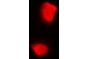 Immunofluorescent analysis of PSMA2 staining in U2OS cells. (PSMA2 抗体)