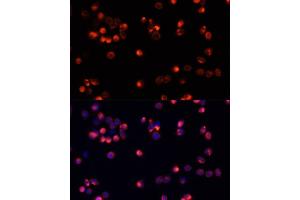 Immunofluorescence analysis of HeLa cells using  antibody (ABIN3020944, ABIN3020945, ABIN3020946 and ABIN6213811) at dilution of 1:100. (AKT2 抗体)