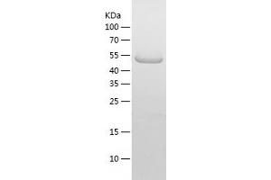 Western Blotting (WB) image for Myocyte Enhancer Factor 2A (MEF2A) (AA 1-499) protein (His tag) (ABIN7124045) (MEF2A Protein (AA 1-499) (His tag))