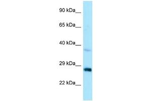 WB Suggested Anti-CTDSP1 Antibody Titration: 1. (CTDSP1 抗体  (N-Term))