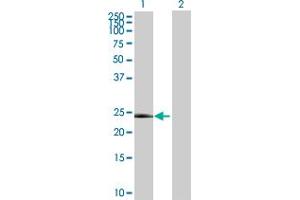 Western Blot analysis of RNF135 expression in transfected 293T cell line by RNF135 MaxPab polyclonal antibody. (RNF135 抗体  (AA 1-210))