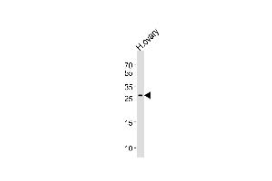 Western blot analysis of lysate from human ovary tissue lysate, using LRRN4CL Antibody (Center) (ABIN656629 and ABIN2845875). (LRRN4CL 抗体  (AA 117-146))
