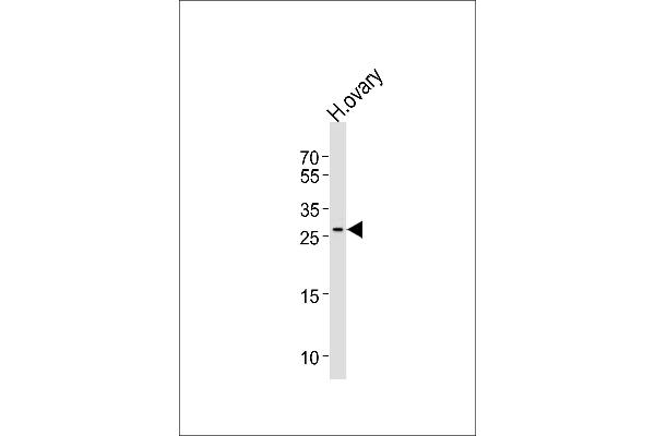 LRRN4CL 抗体  (AA 117-146)