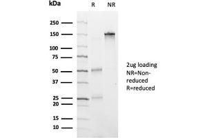 SDS-PAGE Analysis Purified HDAC6 Mouse Monoclonal Antibody (PCRP-HDAC6-1A4). (HDAC6 抗体)