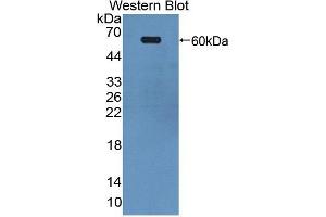Western blot analysis of the recombinant protein. (EPH Receptor A4 抗体  (AA 621-882))