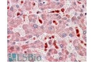 Image no. 3 for anti-PYD and CARD Domain Containing (PYCARD) (C-Term) antibody (ABIN374154) (PYCARD 抗体  (C-Term))