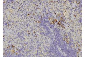 ABIN6278482 at 1/100 staining Human lymph node tissue by IHC-P. (IL32 抗体)