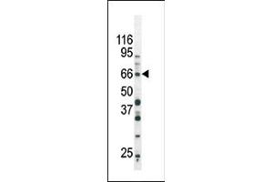 The anti-Phospho-SD3- Pab (ABIN389657 and ABIN2839640) is used in Western blot to detect Phospho-SD3- in Ramos tissue lysate (SMAD3 抗体  (pSer213))