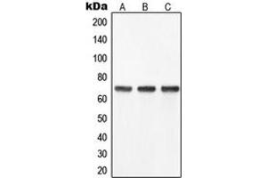 Western blot analysis of YAP1 expression in SW480 (A), HeLa (B), Caco2 (C) whole cell lysates. (YAP1 抗体  (Center))