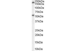 Image no. 1 for anti-Serotonin Receptor 3A (HTR3A) (Internal Region) antibody (ABIN374713) (Serotonin Receptor 3A 抗体  (Internal Region))