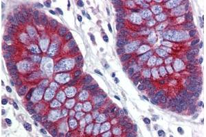 Human Colon (formalin-fixed, paraffin-embedded) stained with ABCA5 antibody ABIN462240 followed by biotinylated goat anti-rabbit IgG secondary antibody ABIN481713, alkaline phosphatase-streptavidin and chromogen. (ABCA5 抗体  (AA 1296-1345))