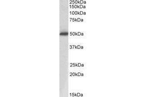 AP20162PU-N ACPP Antibody staining of Human Prostate lysate at 0. (ACPP 抗体  (Internal Region))