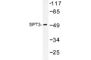 Image no. 1 for anti-Suppressor of Ty 3 Homolog (SUPT3H) antibody (ABIN272144) (SUPT3H/SPT3 抗体)