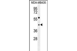 EPHX3 Antibody (C-term) (ABIN655588 and ABIN2845075) western blot analysis in MDA-M cell line lysates (35 μg/lane). (ABHD9 抗体  (C-Term))