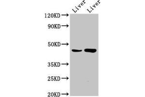 Western Blot Positive WB detected in: Rat liver tissue, Mouse liver tissue All lanes: CHKB antibody at 6. (CHKB 抗体  (AA 2-99))