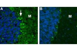 Expression of CaVα2δ2 channel in rat cerebellumImmunohistochemical staining rat cerebellum using Anti-CACNA2D2 (CaVα2δ2) (extracellular) Antibody (ABIN7581837).