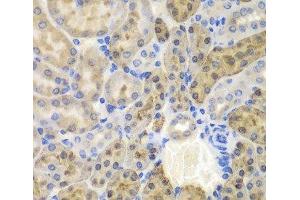 Immunohistochemistry of paraffin-embedded Mouse kidney using AKR1A1 Polyclonal Antibody at dilution of 1:100 (40x lens). (AKR1A1 抗体)