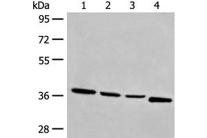 Western blot analysis of Human breast cancer tissue TM4 231 and Jurkat cell lysates using OTUD6A Polyclonal Antibody at dilution of 1:550 (OTUD6A 抗体)