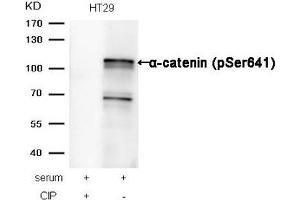 Western blot analysis of extracts from HT29 cells, treated with serum or calf intestinal phosphatase (CIP), using α-catenin (Phospho-Ser641) Antibody. (CTNNA1 抗体  (pSer641))