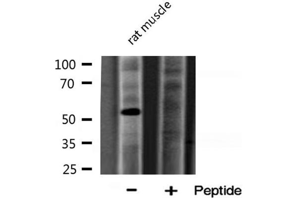 Arylsulfatase A 抗体  (Internal Region)