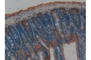 DAB staining on IHC-P; Samples: Rat Intestine Tissue (TFPI 抗体  (AA 29-302))