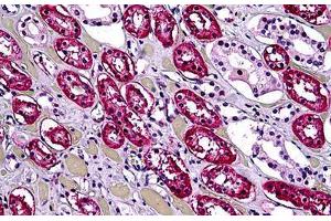 Human Kidney, Tubules: Formalin-Fixed, Paraffin-Embedded (FFPE) (DHX9 抗体  (AA 1-91))
