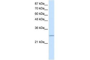 Transfected 293T; WB Suggested Anti-C20ORF20 Antibody Titration: 0. (MRGBP 抗体  (Middle Region))