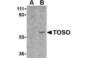 Western Blotting (WB) image for anti-Fas Apoptotic Inhibitory Molecule 3 (FAIM3) (C-Term) antibody (ABIN2476897) (FAIM3 抗体  (C-Term))