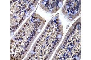 Immunohistochemistry (Paraffin-embedded Sections) (IHC (p)) image for anti-DnaJ (Hsp40) Homolog, Subfamily B, Member 6 (DNAJB6) antibody (ABIN7263009)