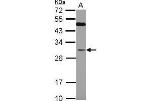 WB Image Sample (30 ug of whole cell lysate) A: Jurkat 12% SDS PAGE antibody diluted at 1:1000 (QDPR 抗体)