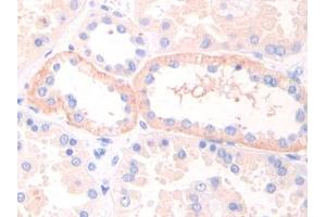 DAB staining on IHC-P; Samples: Human Kidney Tissue (LIFR 抗体  (AA 692-833))