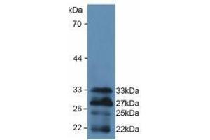 Detection of Recombinant FOXO1, Mouse using Polyclonal Antibody to Forkhead Box Protein O1 (FOXO1)