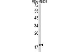 Western Blotting (WB) image for anti-CD28 (CD28) antibody (ABIN3002911) (CD28 抗体)