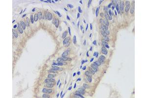 Immunohistochemistry analysis of paraffin-embedded human gallbladder using FAS Monoclonal Antibody at dilution of 1:200. (FAS 抗体)