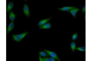 Detection of TUBb in Human MCF7 Cells using Monoclonal Antibody to Tubulin Beta (TUBb) (TUBB 抗体  (AA 170-419))