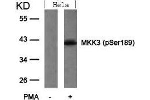 Western blot analysis of extracts from Hela cells untreated or treated with PMA using MKK3(Phospho-Ser189) Antibody. (MAP2K3 抗体  (pSer189))