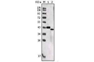 Western Blotting (WB) image for anti-Sortilin-Related Receptor, L(DLR Class) A Repeats Containing (SORL1) (AA 2159-2214) antibody (ABIN1724683)